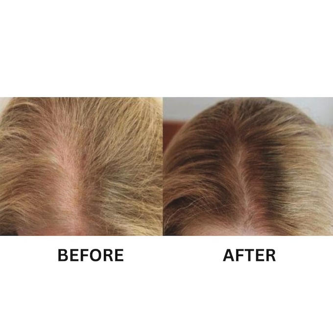 Miracle Hair Cr&egrave;me, , large