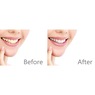 Total White 3-in-1 Teeth Ultrasonic Whitening System, , large