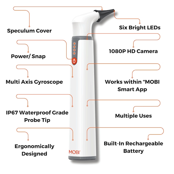 Mobi Smart Ear, Nose & Throat Otoscope, , large