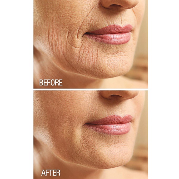 Fat Freezer Neck Firming Cream with Natural Ingredients, , large