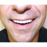 Instant Smile, , large